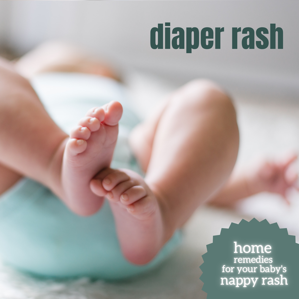 Home Remedies for Diaper Rash (Nappy Rash) - WeHaveKids